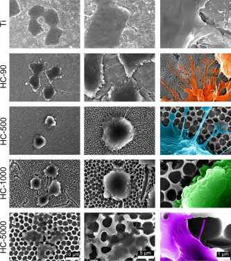 - Material surface morphologies of different samples under scanning electron microscope examination, including flat Ti, nano-structure in 90nm, 500nm, 1000nm and 5000nm
- Cellular morphologies of macrophages on different sample surface (scale bars, 10 μm (first column), 5 μm (second column) and 1 μm (third column))
- The cells on 90nm surface extended more “legs” (filopodia) than those on 500nm, 1000nm and 5000nm.